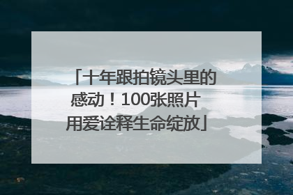 十年跟拍镜头里的感动！100张照片用爱诠释生命绽放