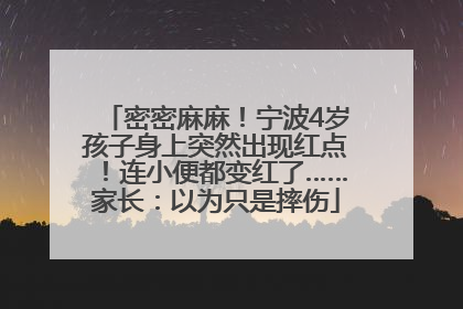 密密麻麻！宁波4岁孩子身上突然出现红点！连小便都变红了……家长：以为只是摔伤